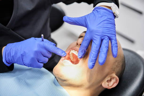 Best Emergency Wisdom Tooth Extraction in Stratford, WI